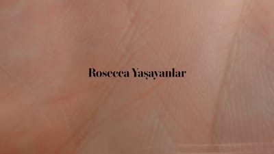 https://video.neoskola.net/thumbnails/courses/6852c1c0af2bdc97d68a297f/lessons/6852c7f1af2bdc97d68a357c-1771781034795.jpg